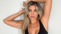Ivana Icardi reveló el problema que sufrió tras su retoque estético