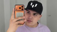 El posteo de Thiago Medina mostrando sus cicatrices a un año de su trágico accidente