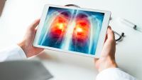 Qué es el adenocarcinoma pulmonar, el tumor que le detectaron al Papa León XIV